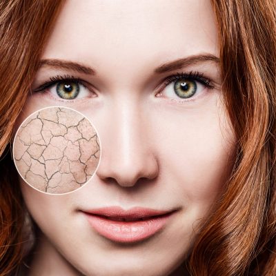 Actie! Herfst huidverzorgingspakket